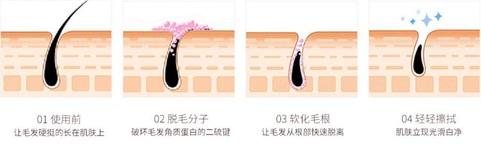 无痛脱毛，轻松摆脱多余毛发的革命性技术