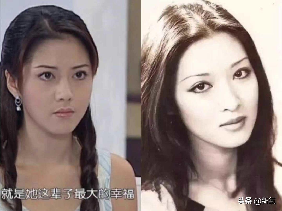 鼻骨整形，重塑自信的面部轮廓