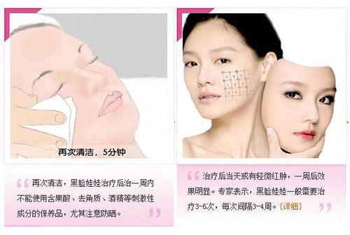 黑脸娃娃美容的价格及其相关因素探讨