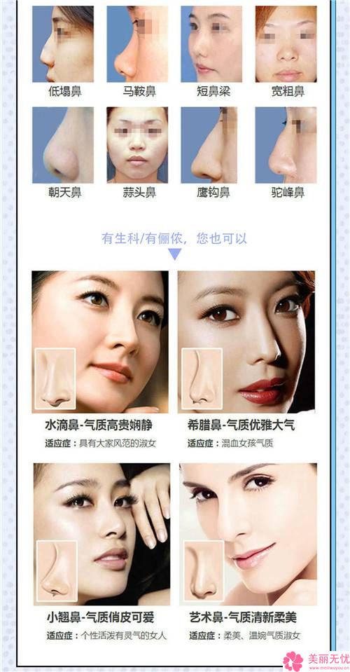 注射隆鼻手术费用详解，多少钱？