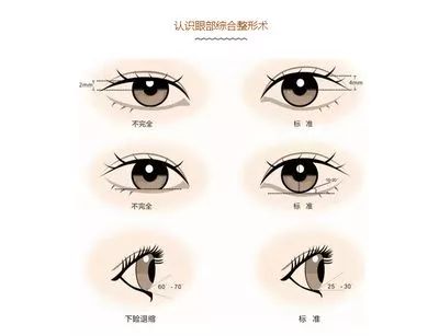 开眼角手术，打造魅力眼神的秘诀