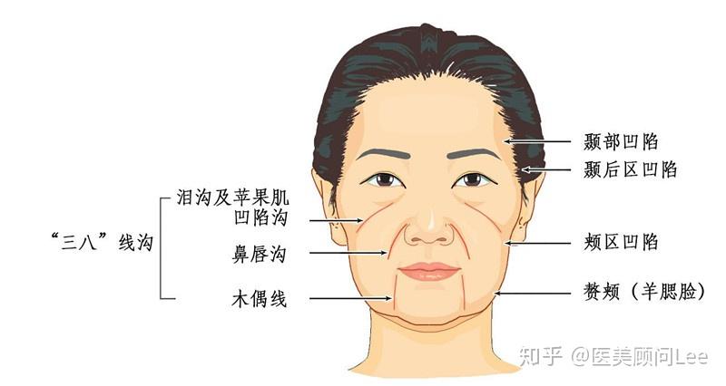 面部注射除皱，价格因素与全面解析
