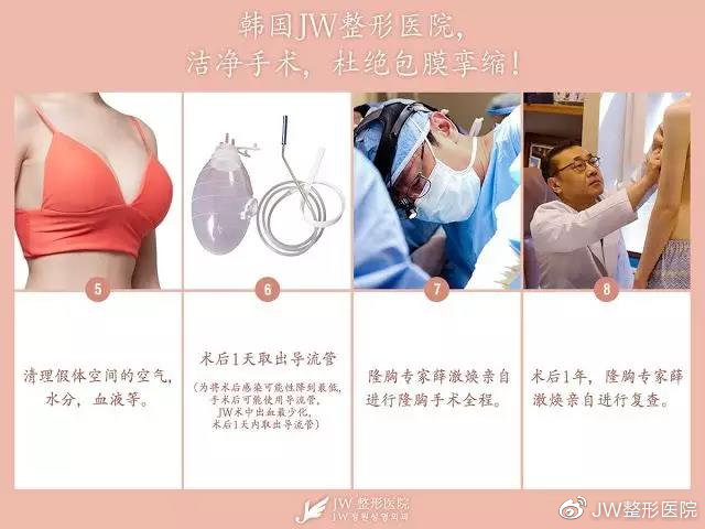 韩式隆胸术，探索现代美容外科的奥秘