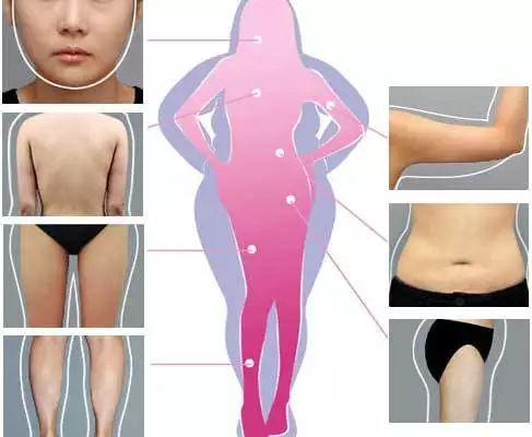 关于大腿吸脂的价格及其相关因素探讨