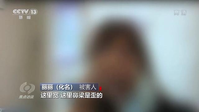 手术祛痘，科技与美丽的完美结合