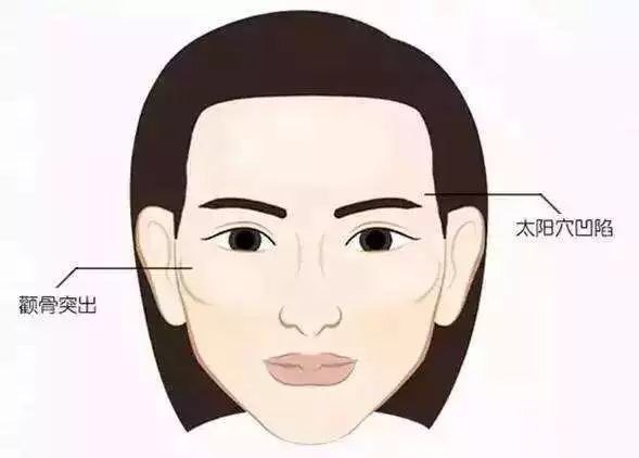 颧骨整形的探索与实践，重塑面部轮廓的艺术