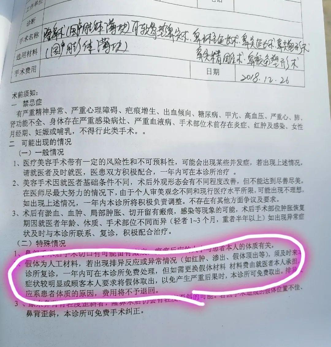 假体隆鼻安全吗，全面解析隆鼻手术的风险与保障