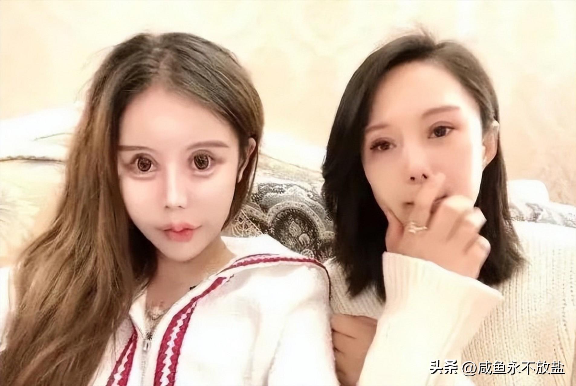 开眼角手术费用详解，了解、准备与选择