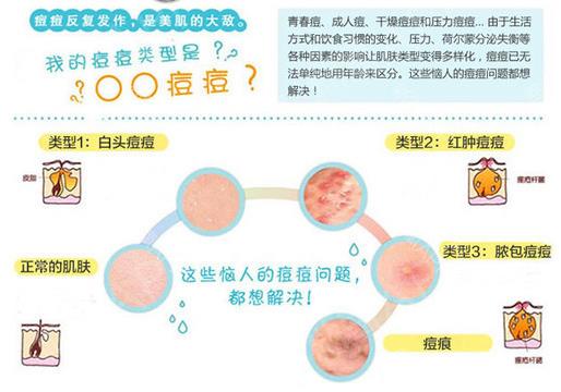 激光去痘痘的费用分析，了解价格背后的因素