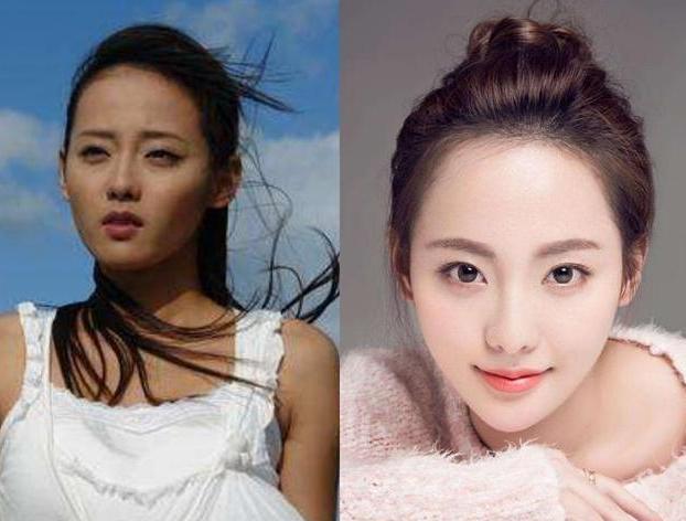 打美白针大概需要多少钱？全面解析美白针价格因素