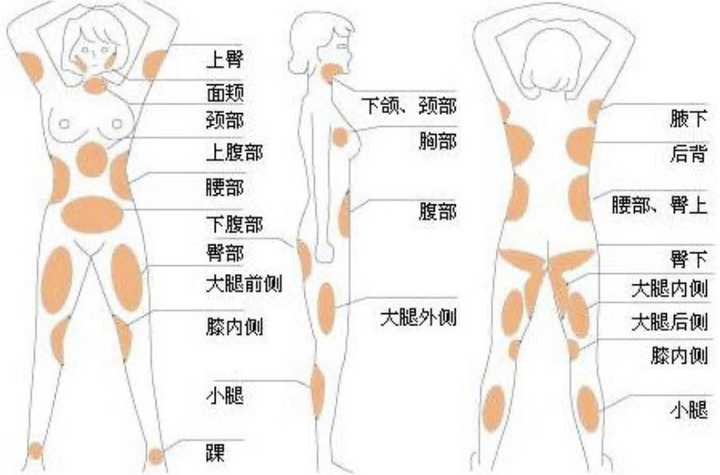 关于大腿吸脂手术价格的文章