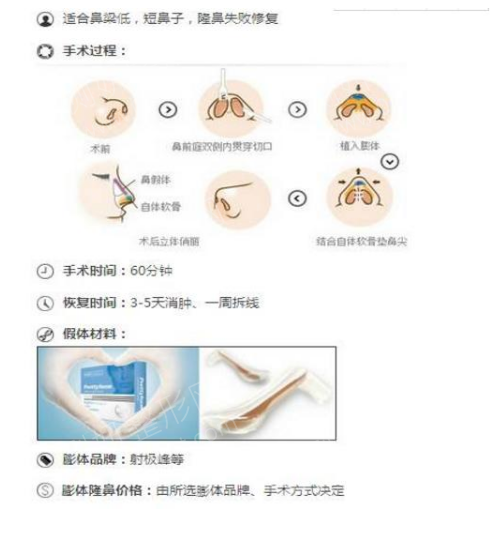 重塑自信，取出鼻假体的过程与体验