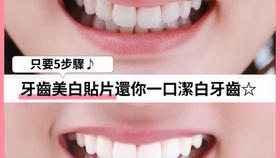 美白牙齿的费用及其相关因素探讨