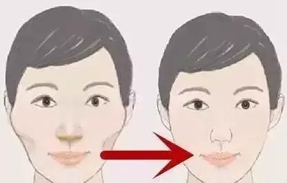 歪脸女孩手术成功，重塑自信，绽放美丽