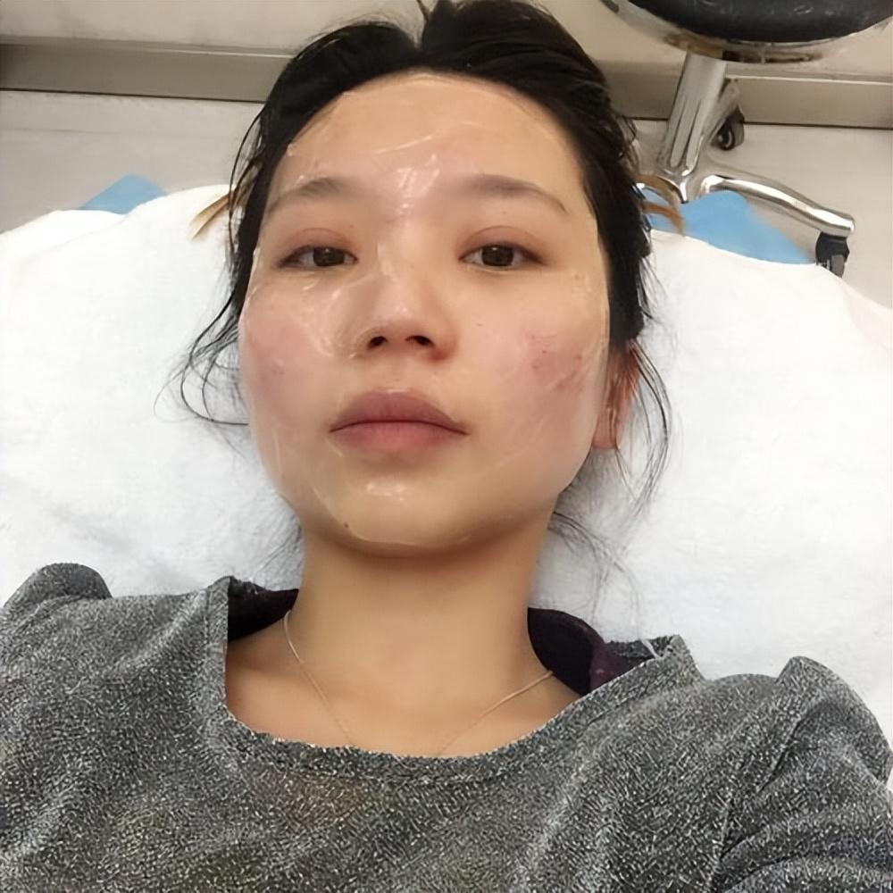 揭秘光子嫩肤的价格，究竟需要多少钱？