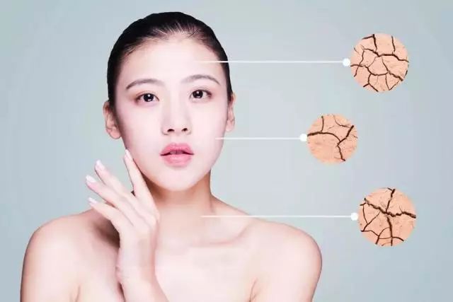 光子嫩肤技术，收缩毛孔的新选择