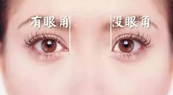 双眼皮与开眼角的魅力，重塑眼部魅力的秘密武器