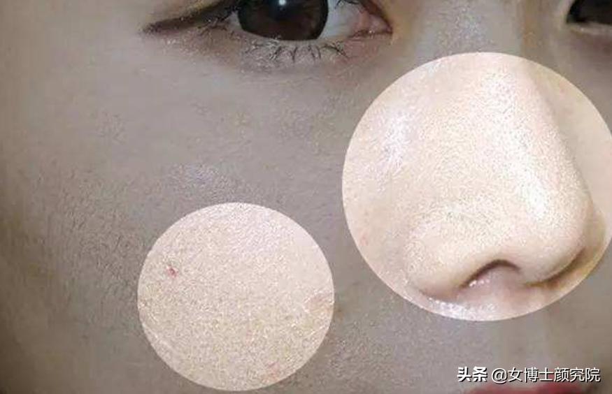 油性皮肤的美白秘籍，探索油性皮肤美白之道