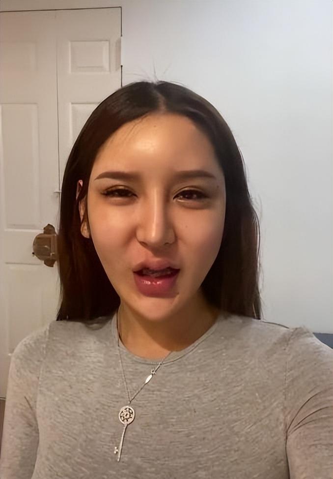 吸脂减肥，重塑自信身材的科学途径