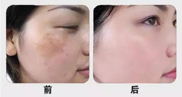 了解与预算选择
