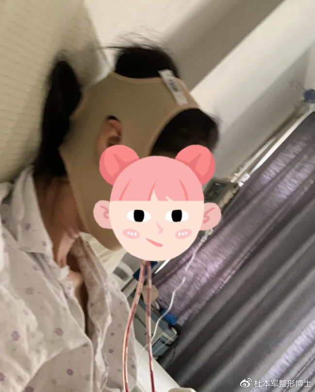 黄奕整容，探索明星美丽背后的故事