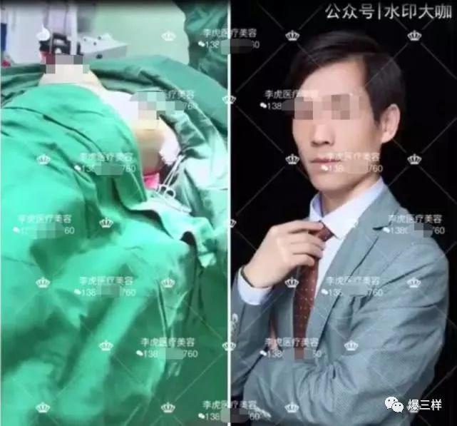 整容需要多少钱，全面解析整形费用构成与影响因素