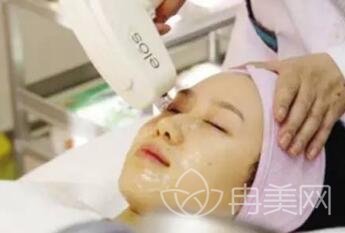 OPT激光美容，重塑美丽的科技新选择