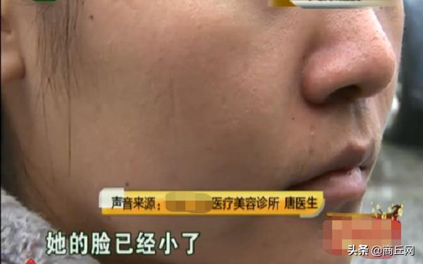 关于瘦脸的费用及其相关因素探讨