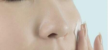 鼻翼缩小手术费用详解