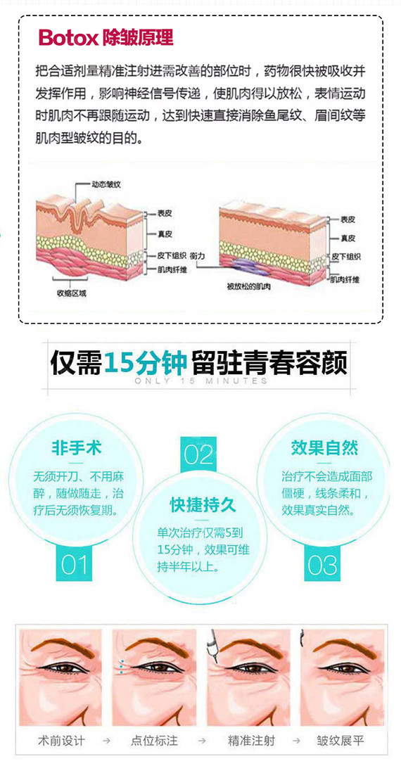 保妥适除皱针，重塑青春的神奇之选