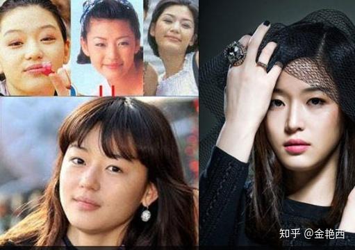 韩国女星整容，美丽背后的故事