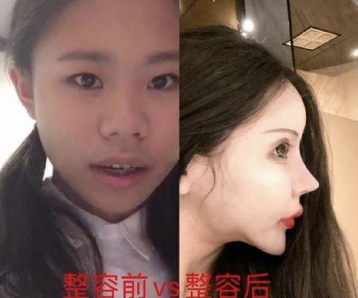 吸脂减肥需要多少钱？全面解析吸脂减肥费用因素