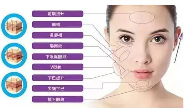 鼻唇沟微整形，重塑面部轮廓的自然美学