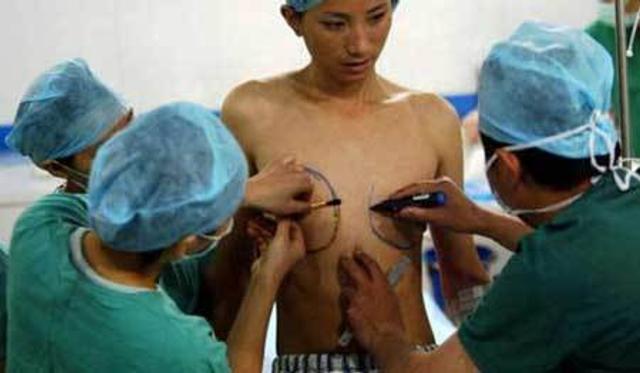 变性手术，男变女过程探究