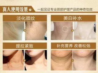 颈部除皱的价格因素与选择