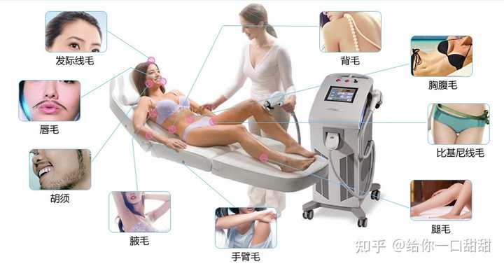 电针脱毛，现代科技下的新型脱毛方式