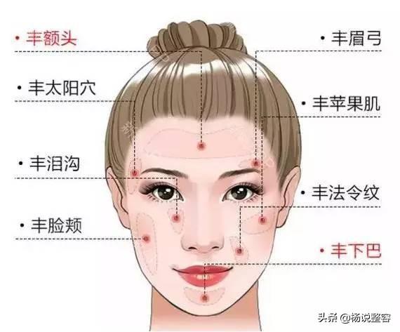 鼻唇沟填充术，重塑面部轮廓的美学革命