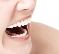 牙齿美白费用详解，多少钱让你拥有灿烂笑容？