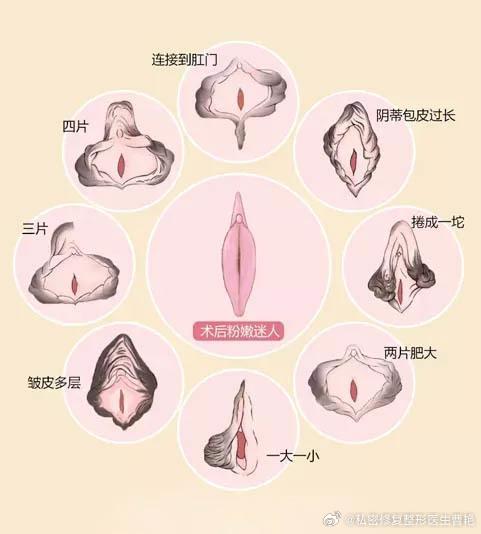 女性私密整形的探索与理解