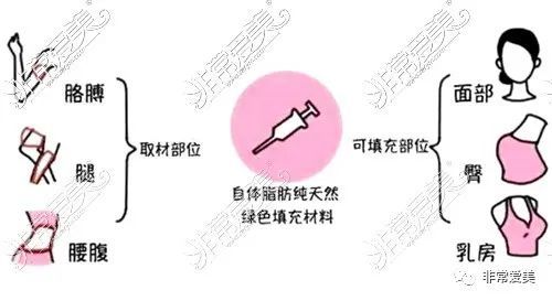 抽脂隆胸手术费用详解