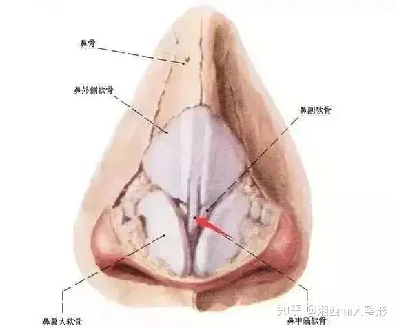 隆鼻材料