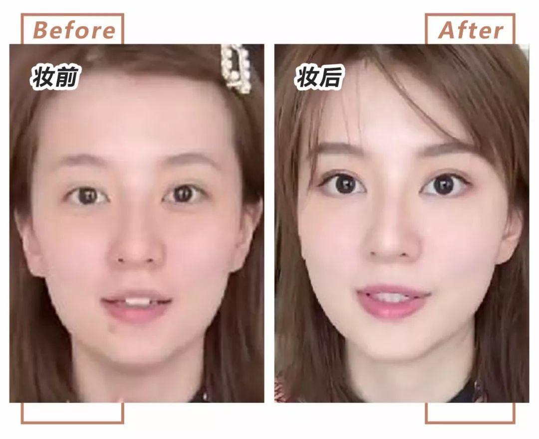 开眼角手术能否让眼睛变大？深度解析与指导建议