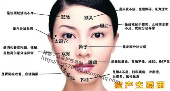 激光治疗痤疮的费用及其相关因素解析