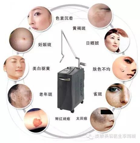 激光祛斑，效果究竟如何？
