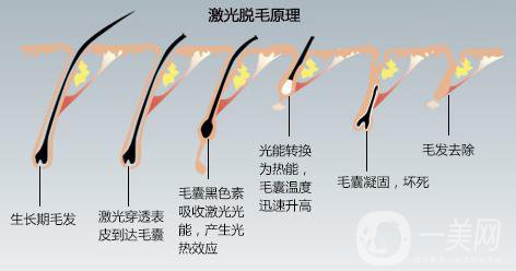 费用因素与注意事项解析
