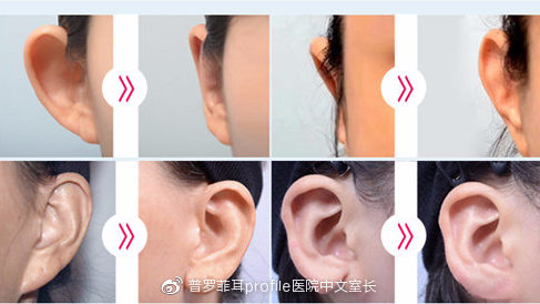 探索与理解