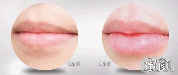 效果深度解析