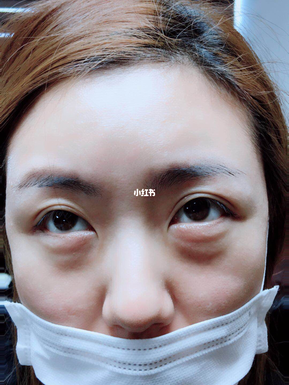 重塑自信美丽