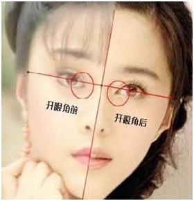 假体隆鼻术，重塑美丽鼻梁的秘密武器