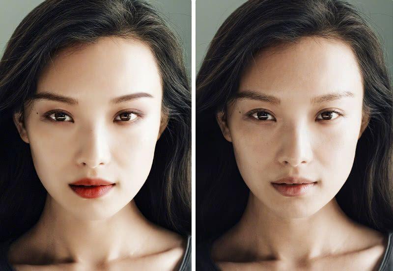 冬天做双眼皮手术是否合适？全面解析双眼皮手术时机与注意事项